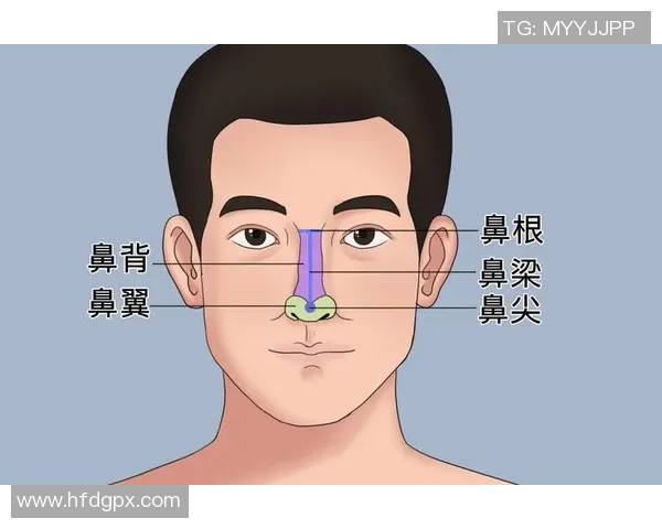 打篮球时不慎撞到鼻子如何处理与预防技巧分享